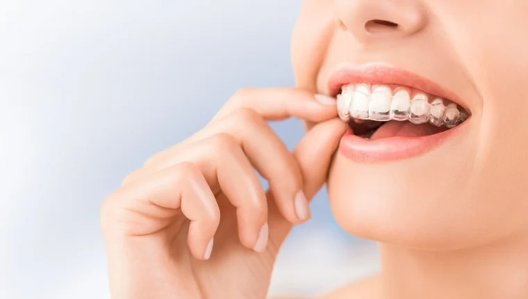 Apparecchio di contenzione ortodontica